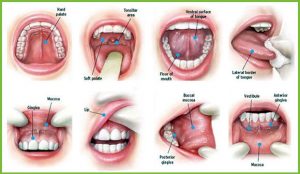 oral cancer screening from Malo Smiles USA