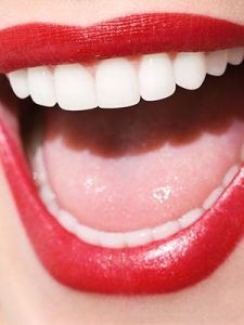 teeth whitening can change yyour smile